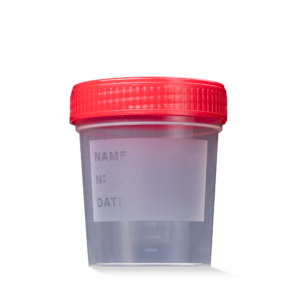 L-09184-R MC Posuda za urin 125 ml sa crvenim zatvaračem