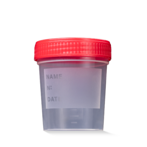 L-09184/1 MC Čaša urinska crveni poklopac 1/1 250 kom