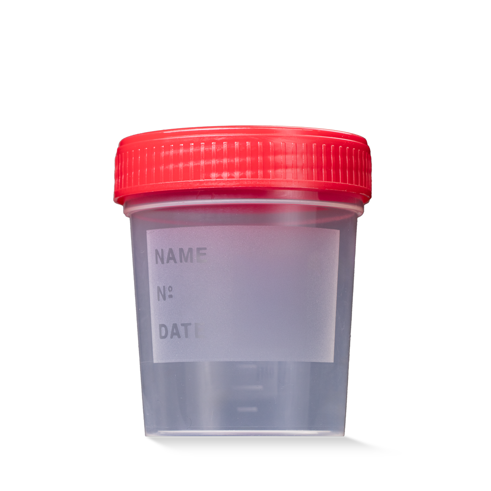 L-09184/1 MC Čaša urinska crveni poklopac 1/1 250 kom