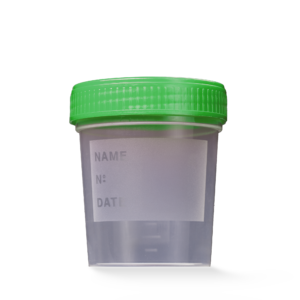 L-09184 MC Posuda za urin 100 mL sa zelenim zatvaračem